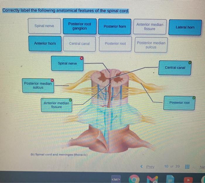 Anatomy neuron cell parts axon body tissue where nervous book another soma structures each its physiology which dendrites called long